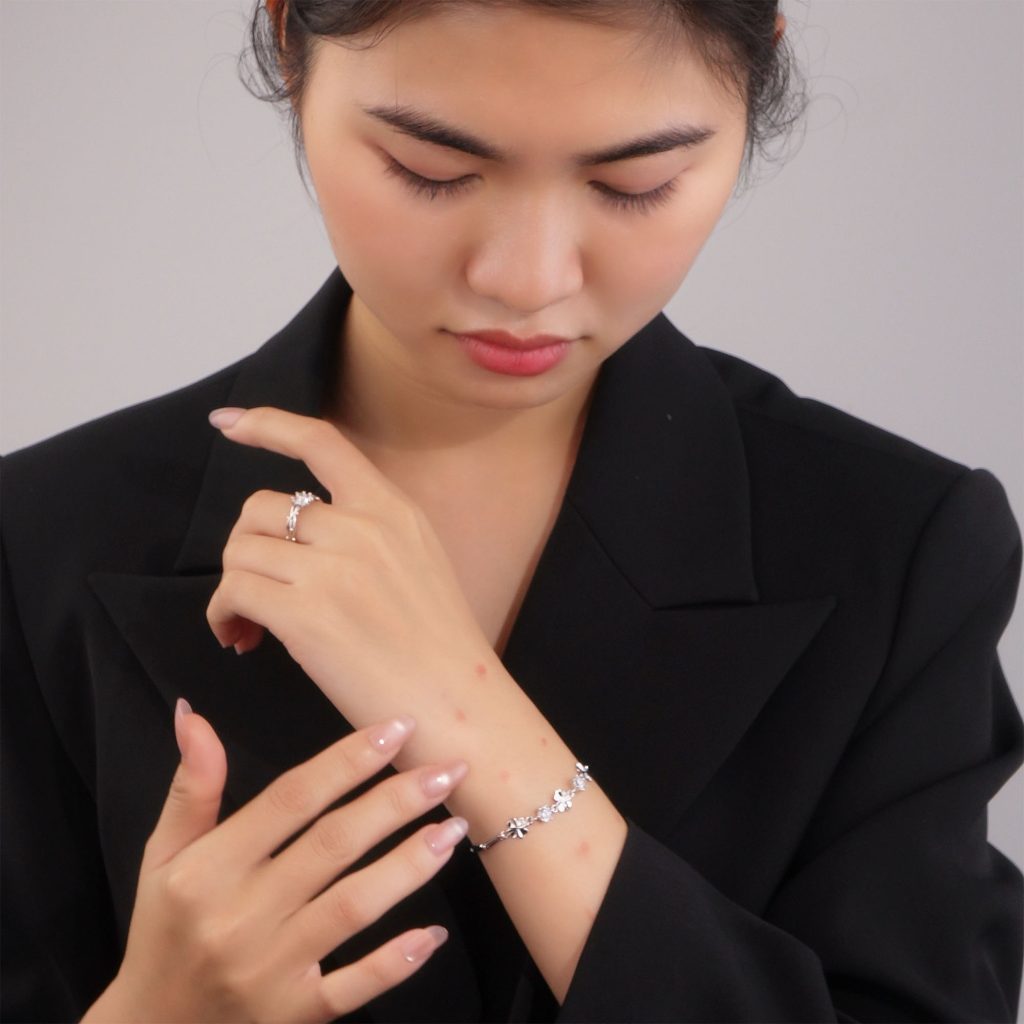 Đeo Bạc Bị Nổi Mẩn Có Nên Tiếp Tục Sử Dụng Không